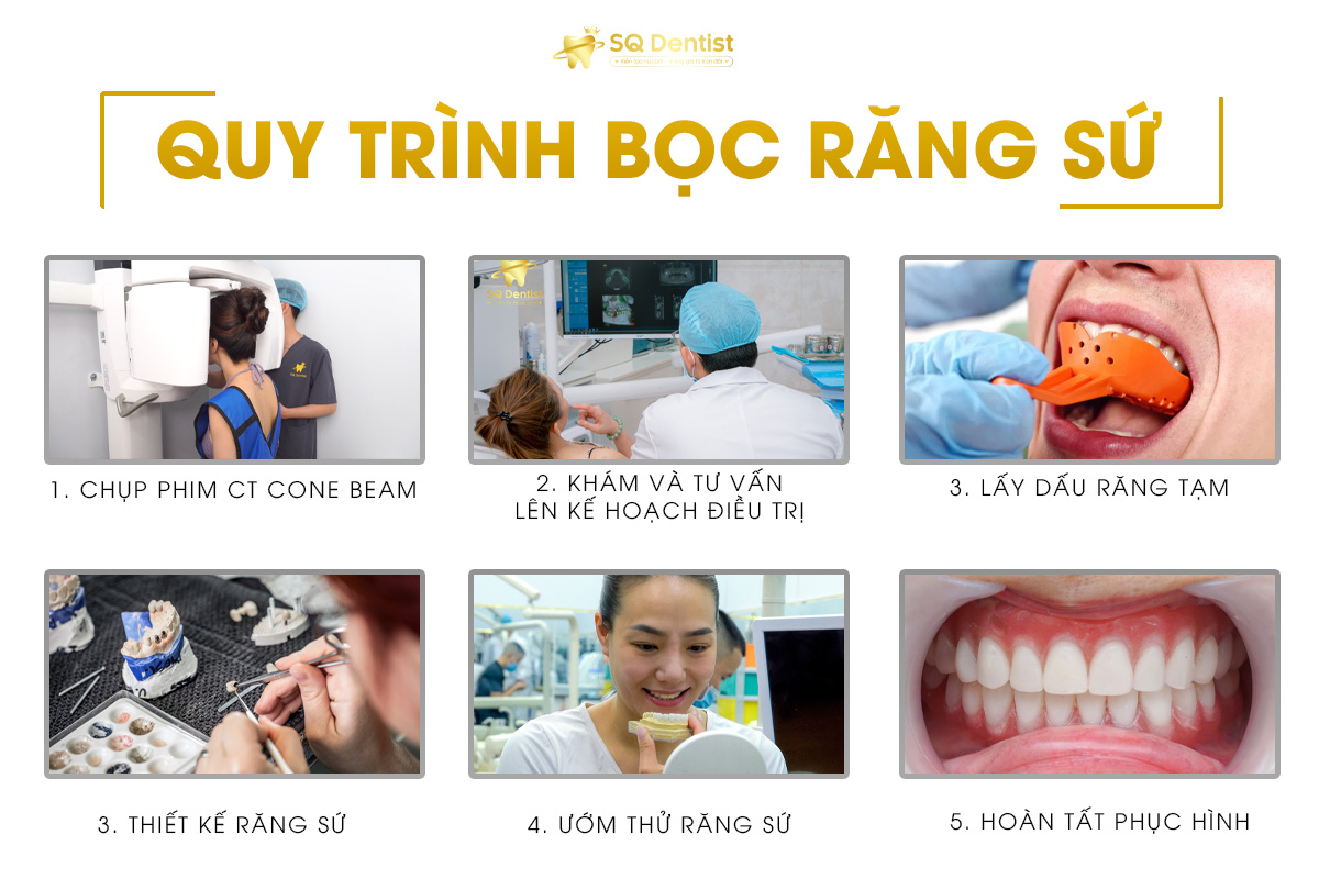 Quy trình bọc răng sứ thẩm mỹ tại SQ Dentist