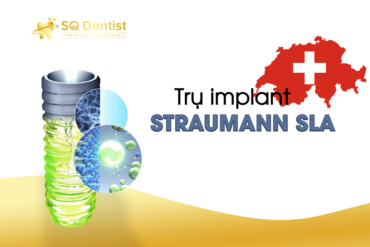 Trụ Implant Straumann Slactive: Cấu Tạo, Đặc Điểm, Chi Phí, Xuất Xứ