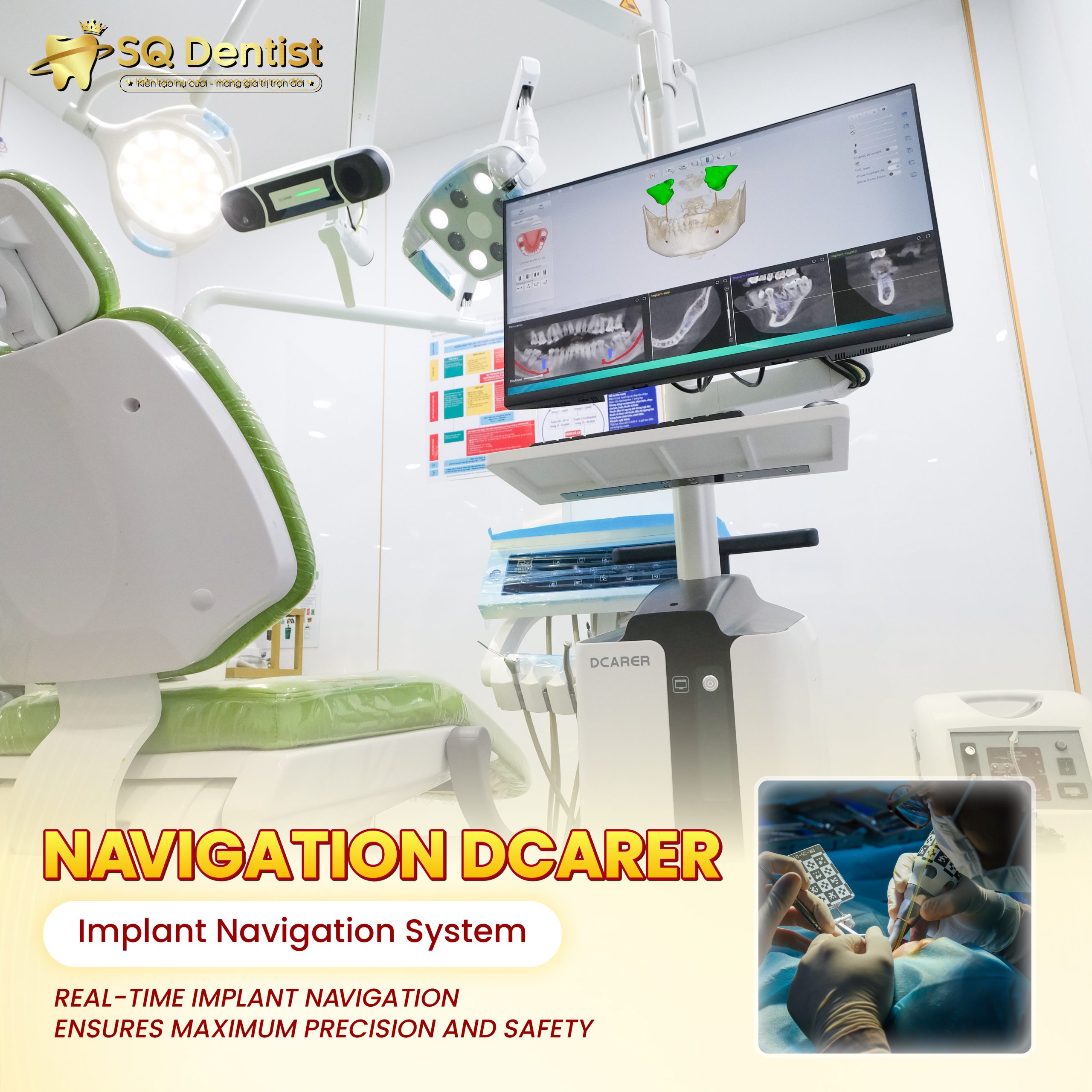 Hệ thống định vị Navigation DCarer được giới thiệu trong tư liệu của SQ Dentist
