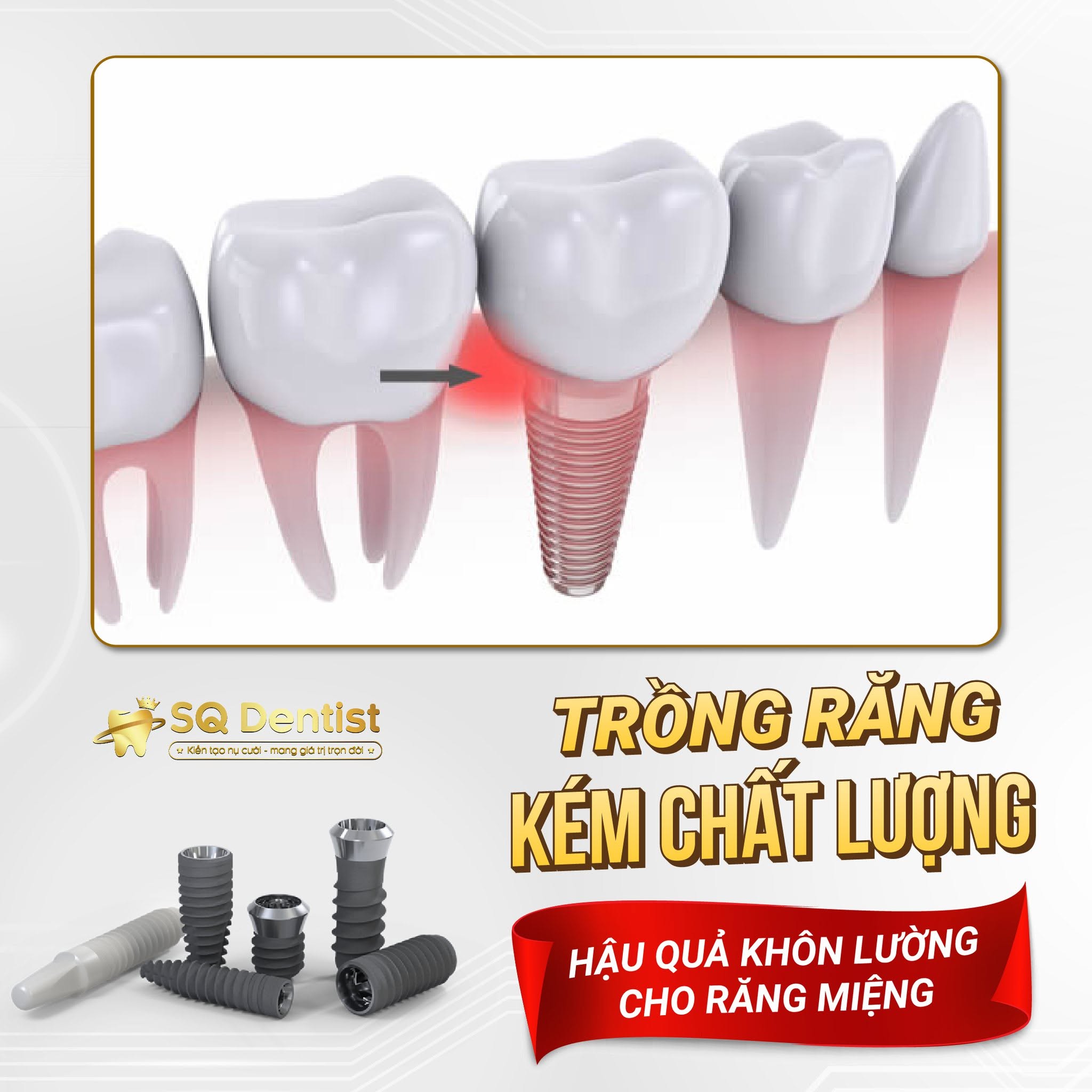 Răng xô lệch