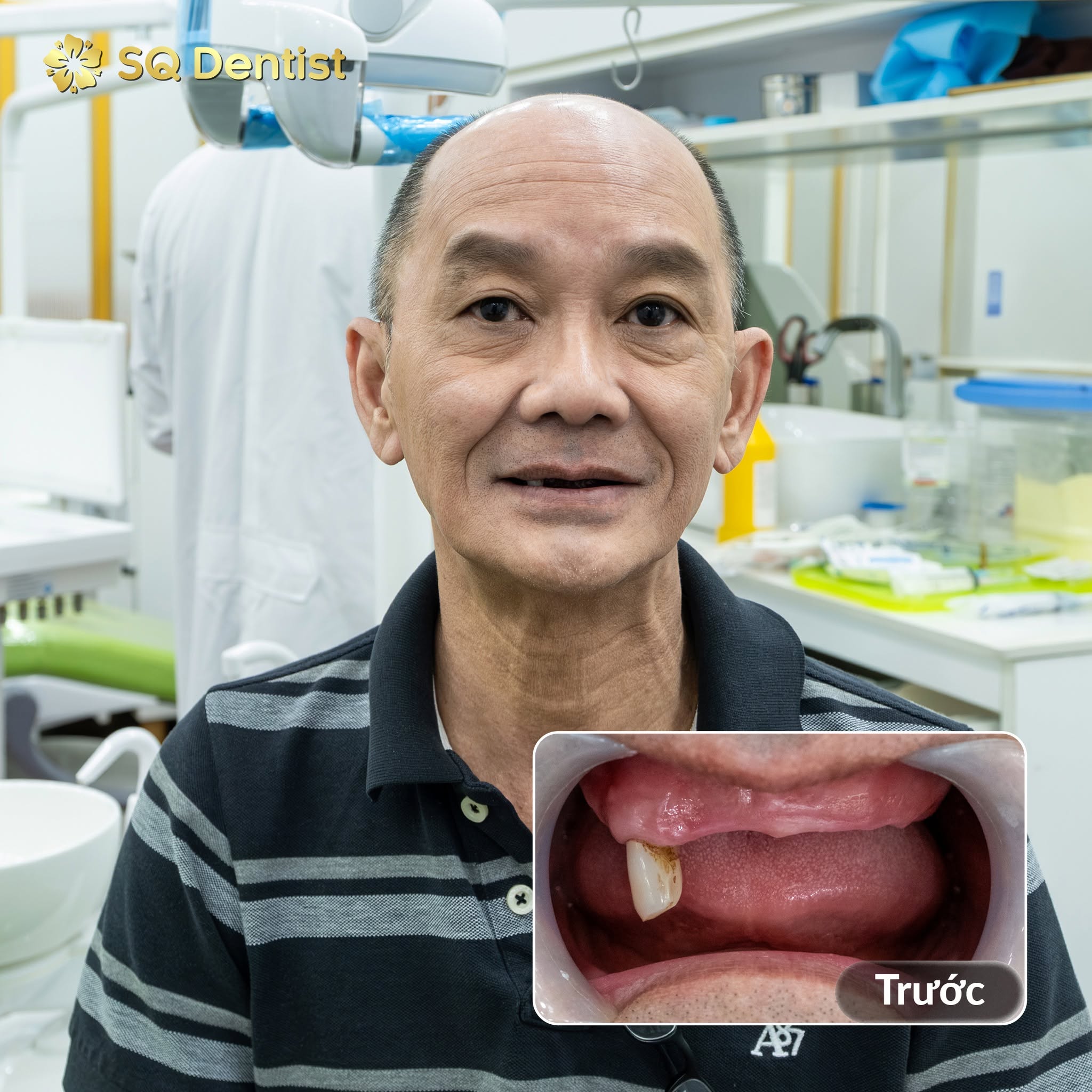 Khách hàng và tình trạng răng trước điều trị tại SQ Dentist